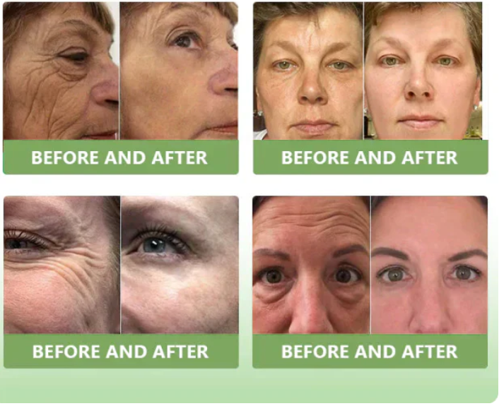 ✨️Advanced Formula 2.0🌿🌿 (🔥LAST DAY SALE-80% OFF🔥)- HZA™ Luxurious Collagen Firming Cream Pro