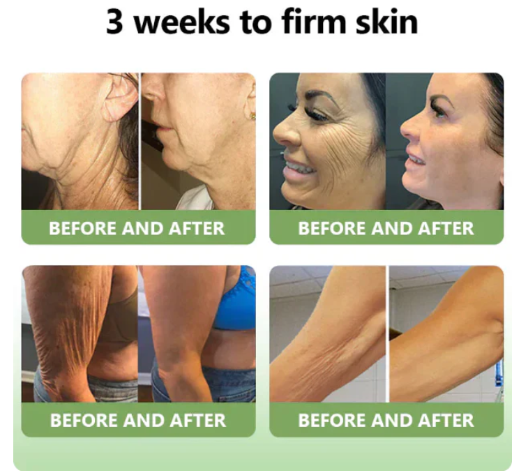 ✨️Advanced Formula 2.0🌿🌿 (🔥LAST DAY SALE-80% OFF🔥)- HZA™ Luxurious Collagen Firming Cream Pro