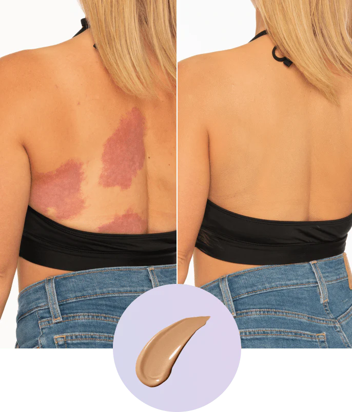 😍Waterproof and sweatproof❌💧Covers full coverage of birthmarks and scars✅Long-lasting coverage