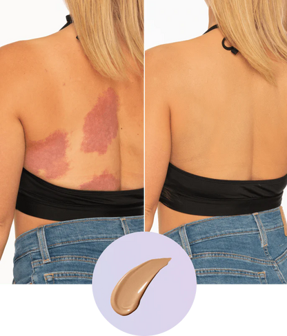 😍Waterproof and sweatproof❌💧Covers full coverage of birthmarks and scars✅Long-lasting coverage