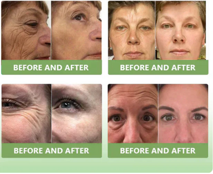 ✨️Advanced Formula 2.0🌿🌿 (🔥LAST DAY SALE-80% OFF🔥)- HZA™ Luxurious Collagen Firming Cream Pro
