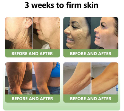 ✨️Advanced Formula 2.0🌿🌿 (🔥LAST DAY SALE-80% OFF🔥)- HZA™ Luxurious Collagen Firming Cream Pro