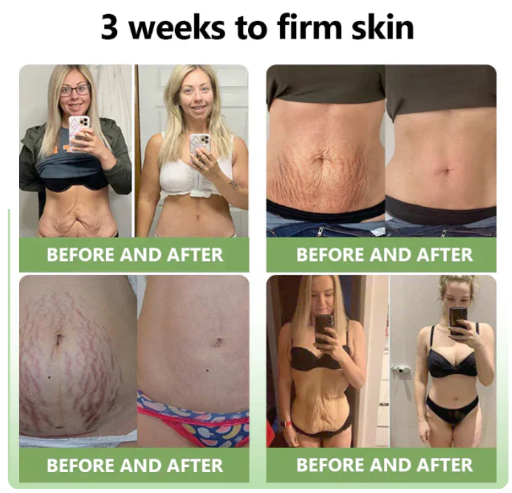 ✨️Advanced Formula 2.0🌿🌿 (🔥LAST DAY SALE-80% OFF🔥)- HZA™ Luxurious Collagen Firming Cream Pro
