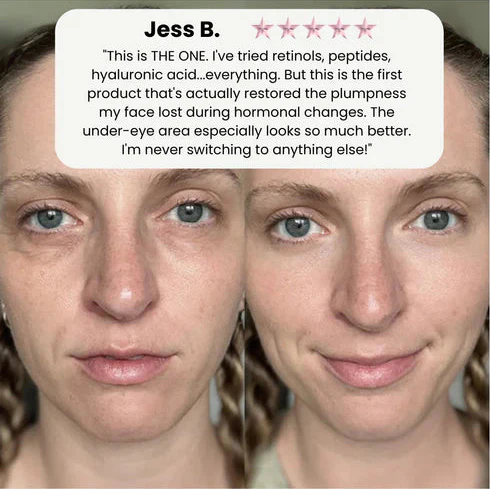 Limited-Time Offer Glow Up Serum — Volufiline + Collagen “Cream-in-Serum”