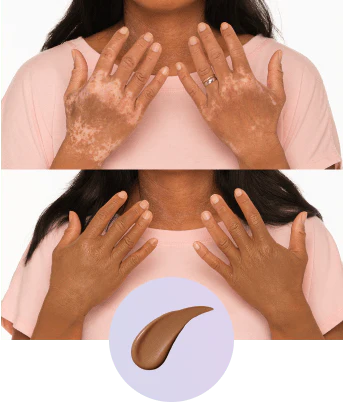 😍Waterproof and sweatproof❌💧Covers full coverage of birthmarks and scars✅Long-lasting coverage