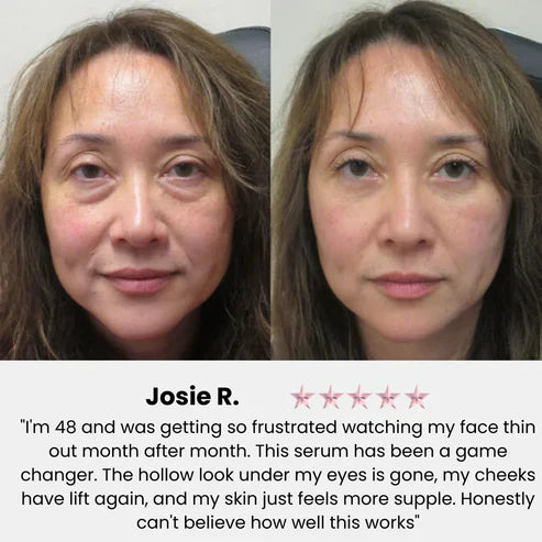 Limited-Time Offer Glow Up Serum — Volufiline + Collagen “Cream-in-Serum”