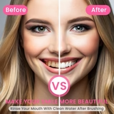 Eptchn Triple Whitening Niacinamide Toothpaste