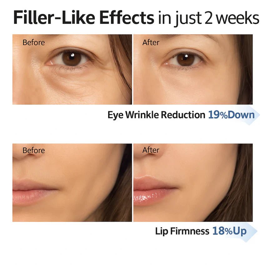 Korean Collagen Boosting Anti-Wrinkle Serum – Volufiline, Elasticity & Glass Skin Hydration