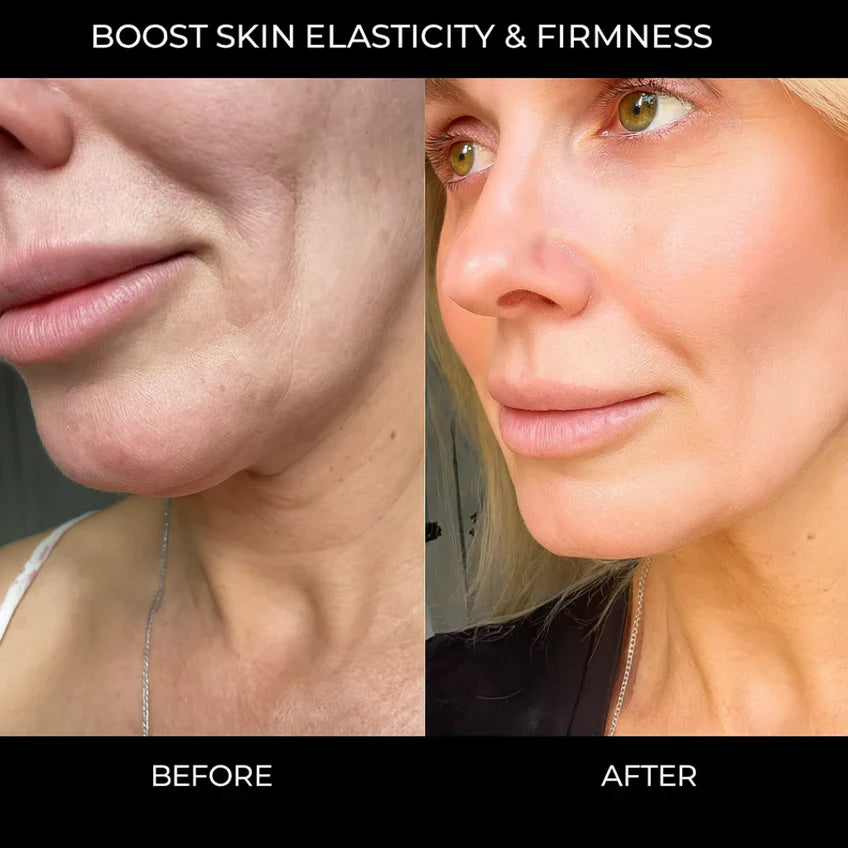 Korean Collagen Boosting Anti-Wrinkle Serum – Volufiline, Elasticity & Glass Skin Hydration