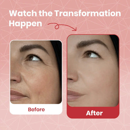 Centella Cream for Mature, Dry & Sensitive Skin