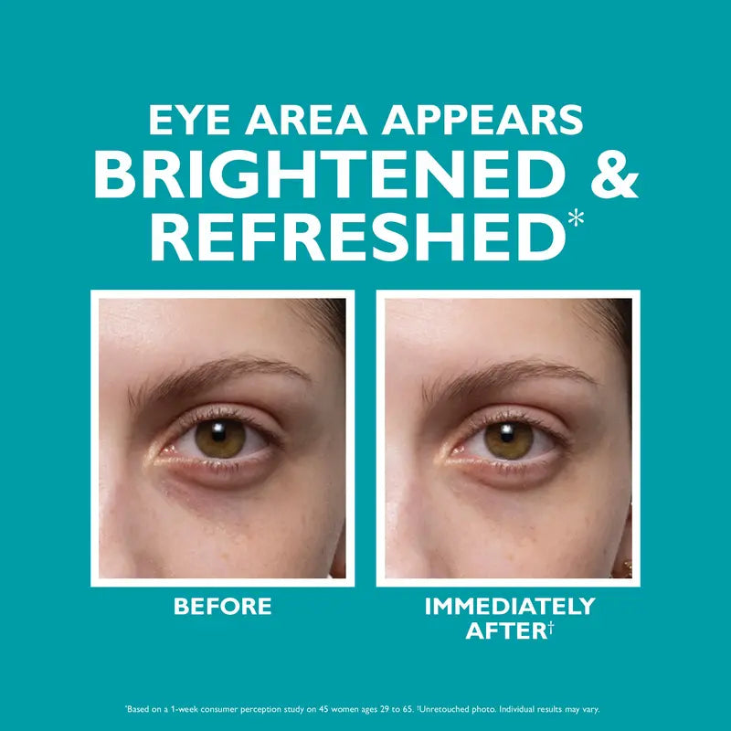 🏆Flash Sale ✨ PEPTIDE SKINJECTION FILL+ FIX UNDER-EYE CREAM ✨The secret to making your eyes look 5 years younger!👁️